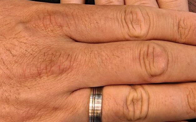 couple engagement rings